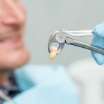 Tips For Tooth Extraction Medicine