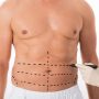 Everything To Know About Male Tummy Tuck