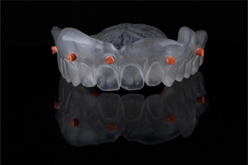A Review of Digital Dental Impressions