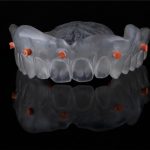 A Review of Digital Dental Impressions