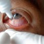 Cyclosporine Eye Drops Side Effects