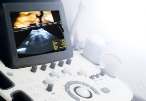 get an ultrasound when pregnant